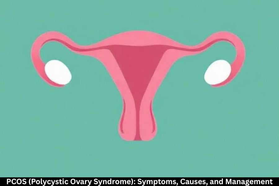 PCOS (Polycystic Ovary Syndrome): Symptoms, Causes, and Management
