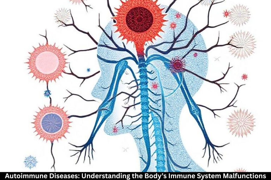 Autoimmune Diseases: Understanding the Body’s Immune System Malfunctions
