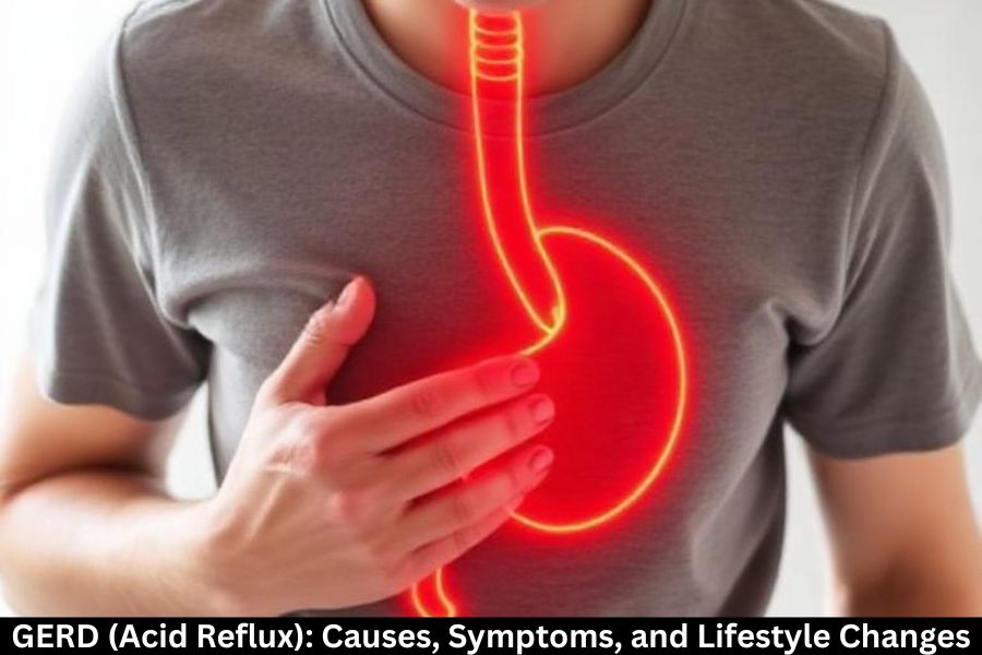 GERD (Acid Reflux): Causes, Symptoms, and Lifestyle Changes