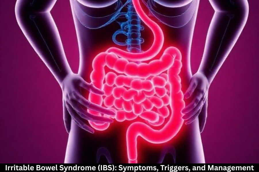 Irritable Bowel Syndrome (IBS): Symptoms, Triggers, and Management