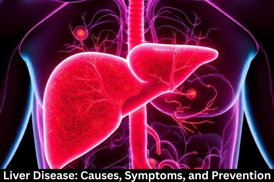 Liver Disease: Causes, Symptoms, and Prevention
