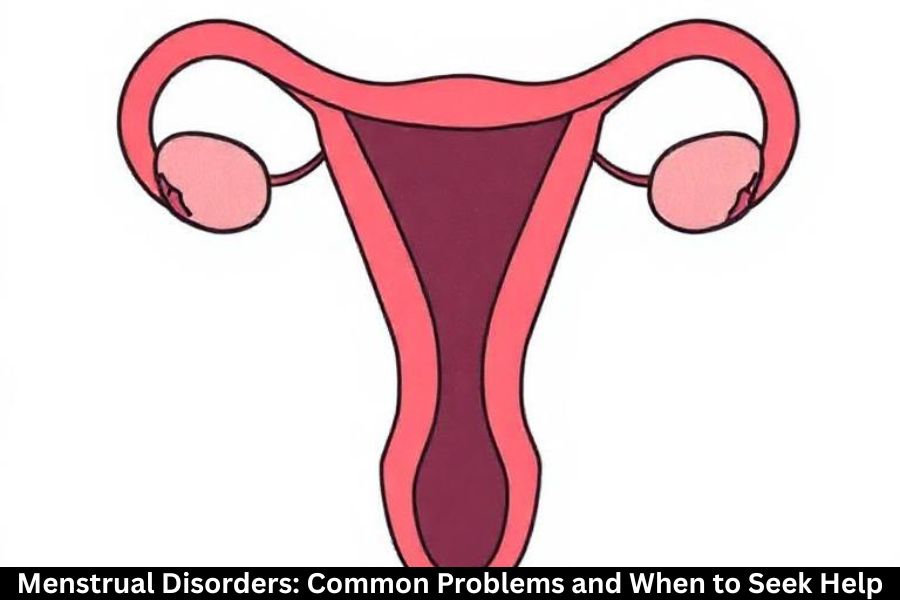 Menstrual Disorders: Common Problems and When to Seek Help